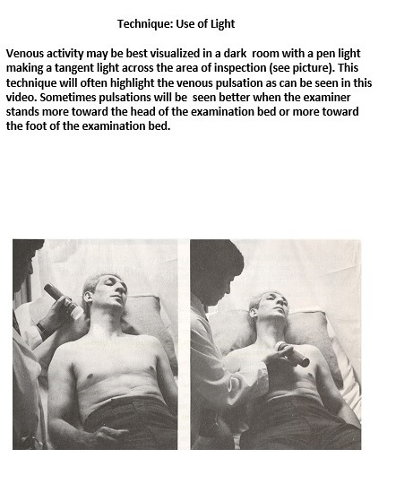 Image showing neck vein landmarks